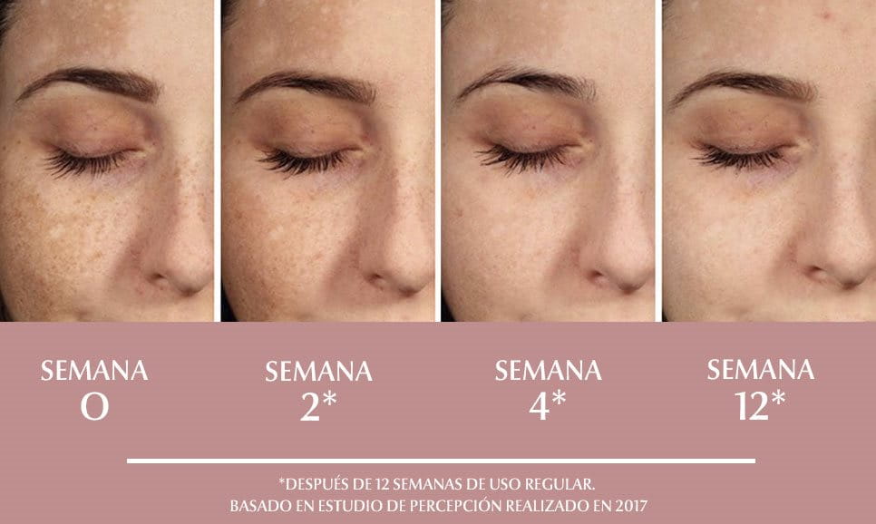 ANTI PIGMENT Hiperpigmentaci n Eucerin anti-pigment-hiperpigmentaci-n-eucerin